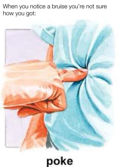 Gloved hand meme poking unknown bruise you do not remember getting