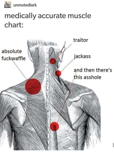 Muscle chart meme naming annoying back pain spots
