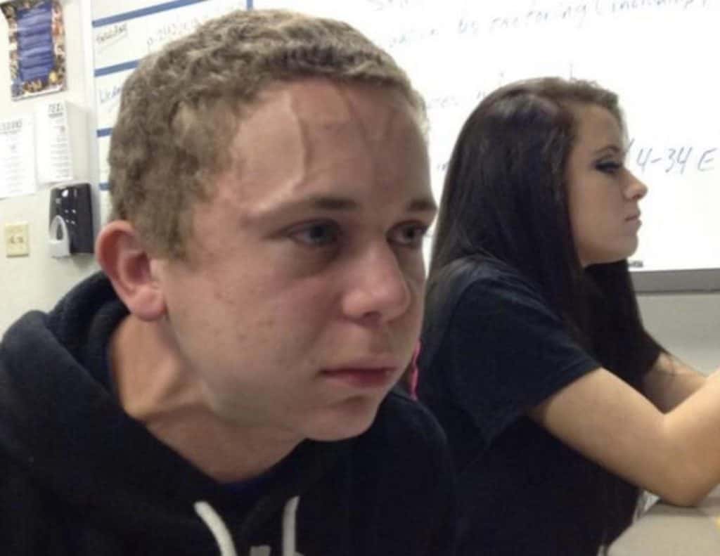 Vein Forehead Guy Meme Templates