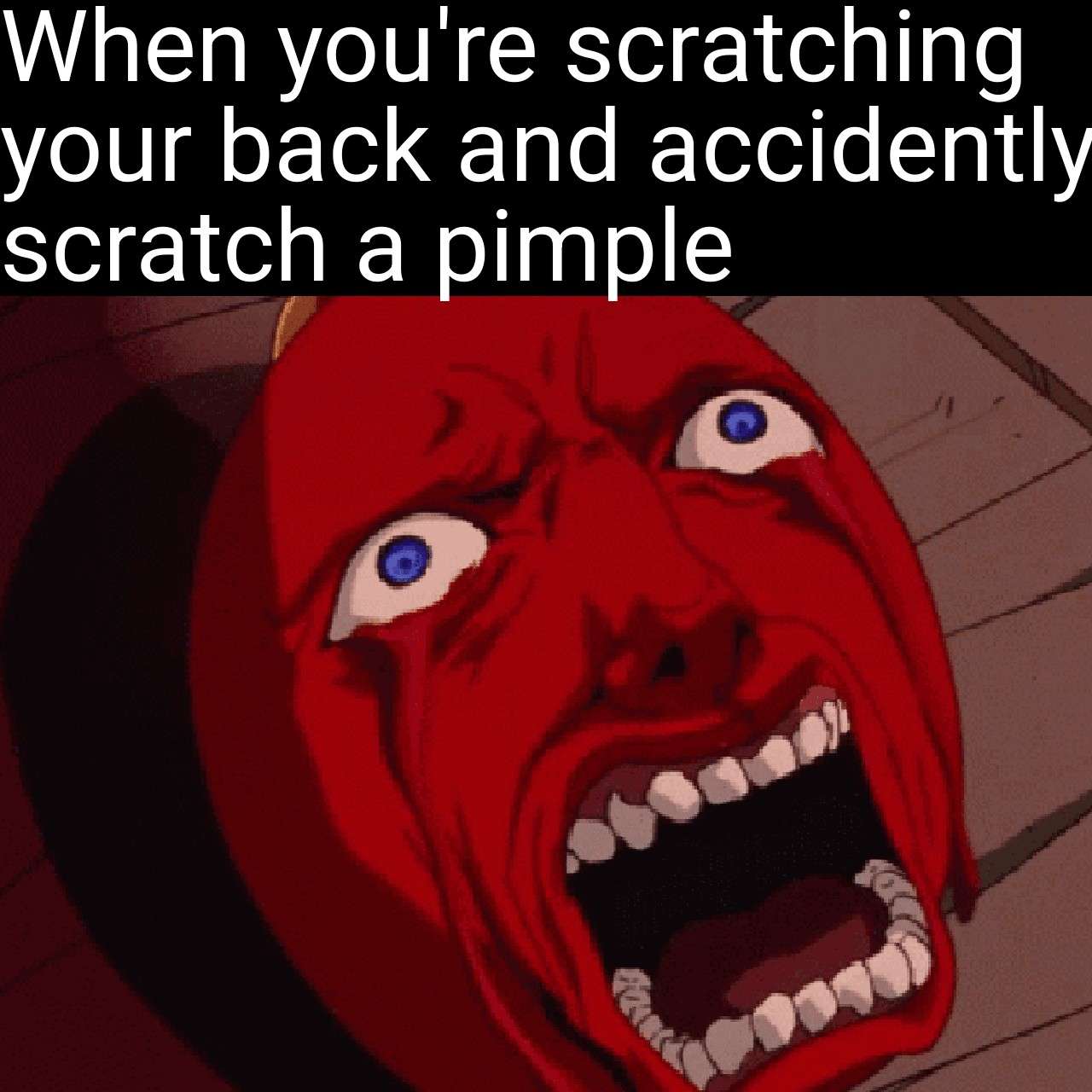 Anime red face scream meme scratching a pimple on your back