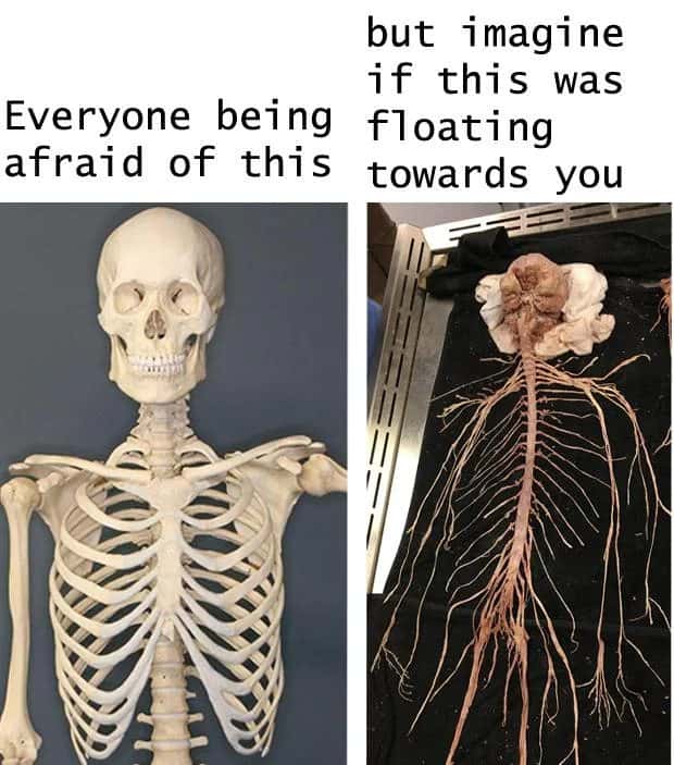 Skeleton meme scares everyone while nervous system floats towards you