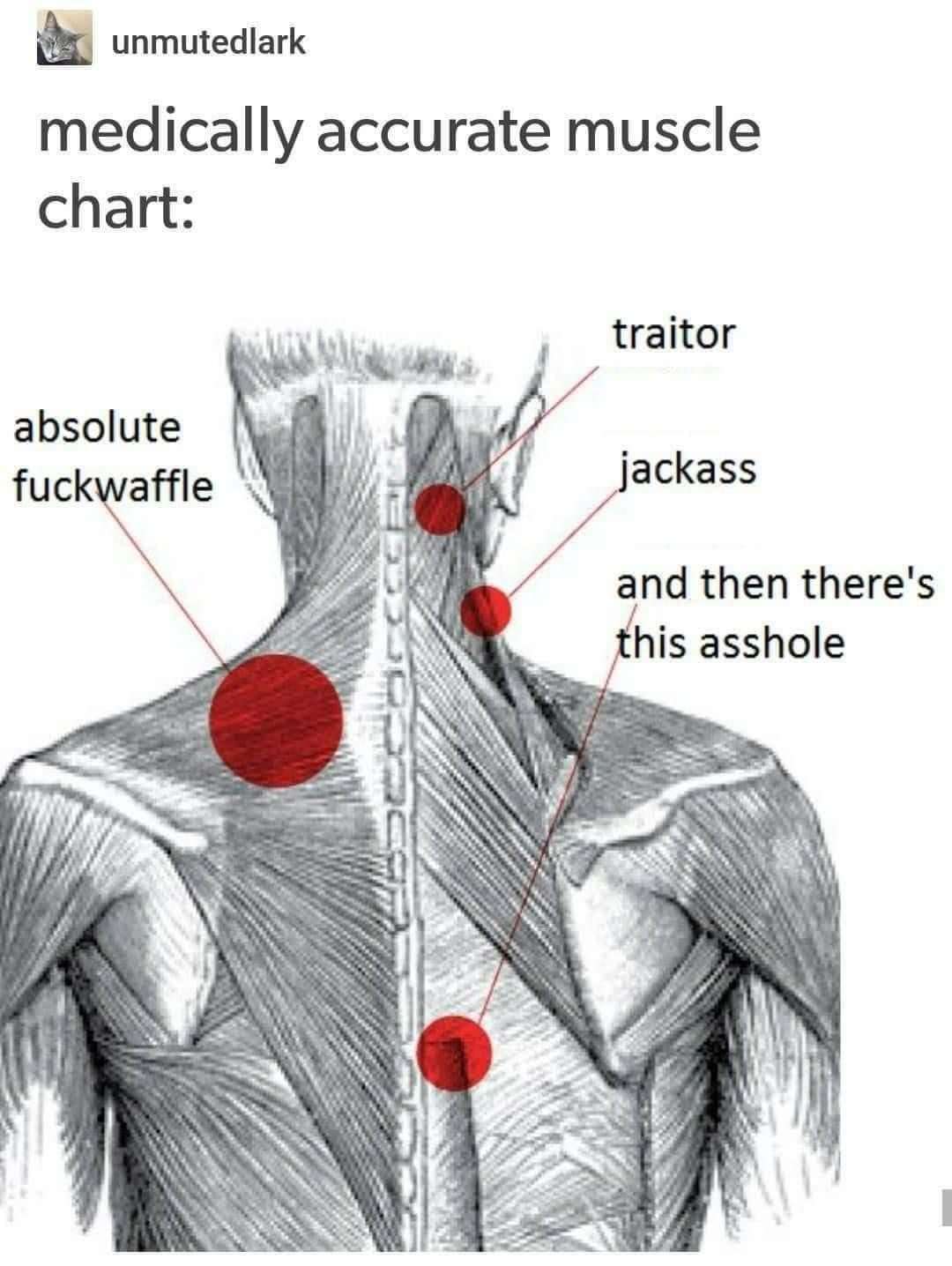 Muscle chart meme naming annoying back pain spots