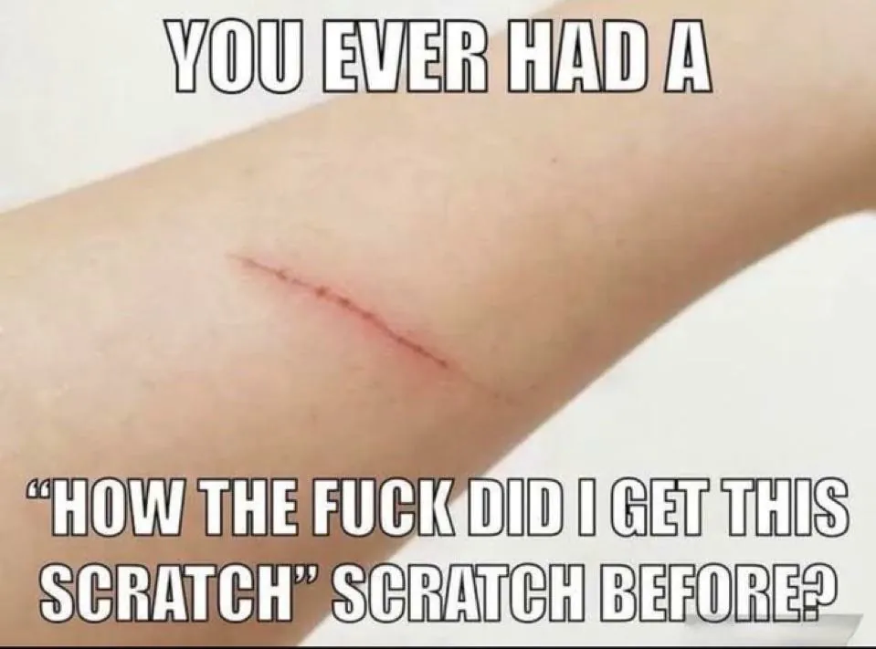Random Scratch Meme: how the fuck did i get this scratch